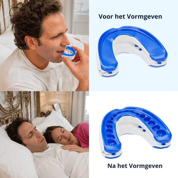 AntiSnore Max | Stille Nachten, Sterkere Liefde